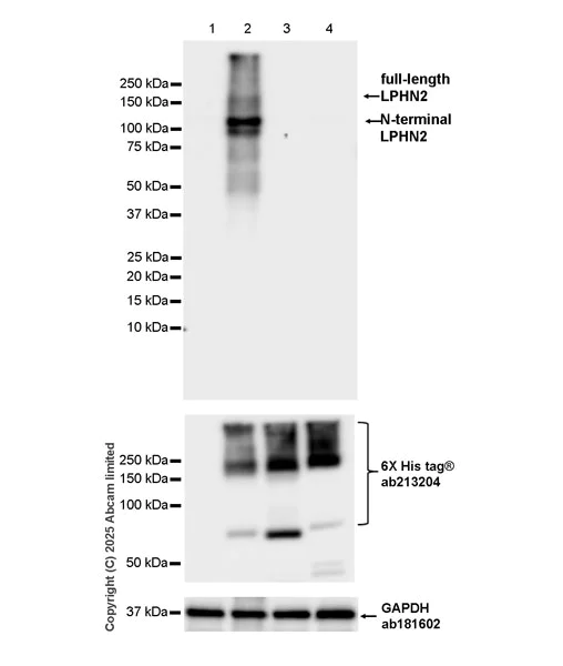 Western blot - Anti-N-terminal LPHN2 antibody [EPR29557-9] (AB324484)