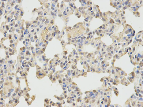 Immunohistochemistry (Formalin/PFA-fixed paraffin-embedded sections) - Anti-N WASP antibody (AB187527)