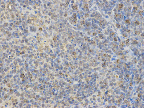 Immunohistochemistry (Formalin/PFA-fixed paraffin-embedded sections) - Anti-N WASP antibody (AB187527)