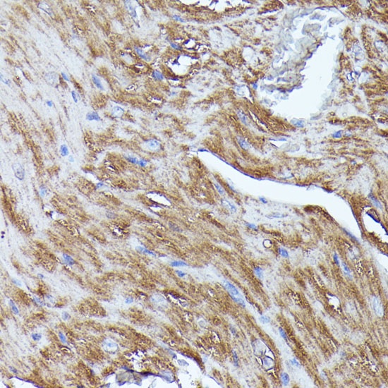 Immunohistochemistry (Formalin/PFA-fixed paraffin-embedded sections) - Anti-N WASP antibody (AB187527)
