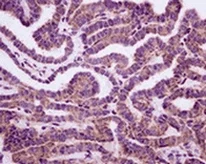 Immunohistochemistry (Formalin/PFA-fixed paraffin-embedded sections) - Anti-N WASP antibody [EPR6959] (AB126626)