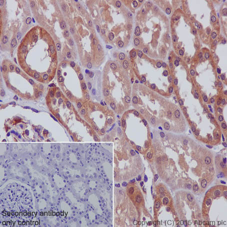 Immunohistochemistry (Formalin/PFA-fixed paraffin-embedded sections) - Anti-N WASP antibody [EPR6959] (AB126626), expandable thumbnail