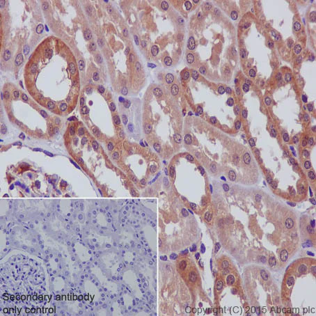 Immunohistochemistry (Formalin/PFA-fixed paraffin-embedded sections) - Anti-N WASP antibody [EPR6959] (AB126626)