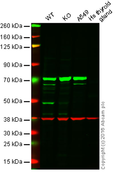 Western blot - Anti-N WASP antibody [EPR6959] (AB126626), expandable thumbnail