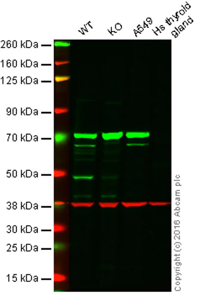 Western blot - Anti-N WASP antibody [EPR6959] (AB126626)