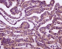 Immunohistochemistry (Formalin/PFA-fixed paraffin-embedded sections) - Anti-N WASP antibody [EPR6959] - BSA and Azide free (AB232457)
