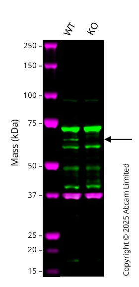 Western blot - Anti-N WASP antibody [EPR6959] - BSA and Azide free (AB232457)