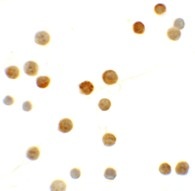 Immunocytochemistry - Anti-N4BP1 antibody (AB106649)