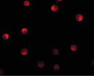 Immunocytochemistry - Anti-N4BP1 antibody (AB106649)