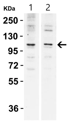 Western blot - Anti-N4BP1 antibody (AB106649)