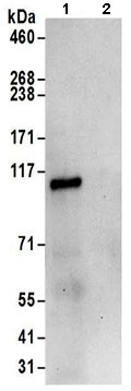 Immunoprecipitation - Anti-N4BP1 antibody (AB197079)
