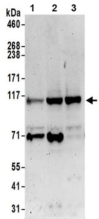 Western blot - Anti-N4BP1 antibody (AB197079)