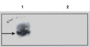 Southern Blot - Anti-N6-methyladenosine (m6A) antibody [17-3-4-1] (AB208577), expandable thumbnail