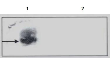 Southern Blot - Anti-N6-methyladenosine (m6A) antibody [17-3-4-1] (AB208577)
