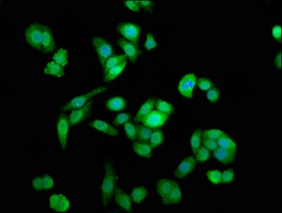 Immunocytochemistry/ Immunofluorescence - Anti-NAA38 antibody (AB236965), expandable thumbnail