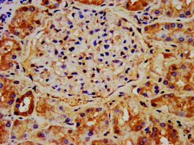 Immunohistochemistry (Formalin/PFA-fixed paraffin-embedded sections) - Anti-NAA38 antibody (AB236965)