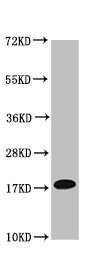 Western blot - Anti-NAA38 antibody (AB236965)