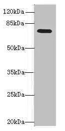 Western blot - Anti-NAALADL2 antibody (AB236991)
