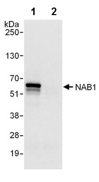 Immunoprecipitation - Anti-NAB1 antibody (AB241305), expandable thumbnail