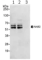 Immunoprecipitation - Anti-Nab2 antibody (AB112056)