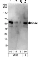 Western blot - Anti-Nab2 antibody (AB112056)