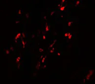 Immunocytochemistry/ Immunofluorescence - Anti-NABC1 antibody (AB106661)