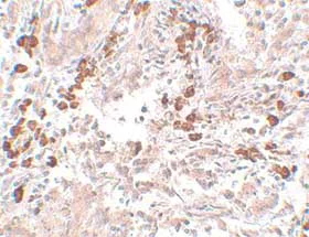 Immunohistochemistry (Formalin/PFA-fixed paraffin-embedded sections) - Anti-NABC1 antibody (AB106661)
