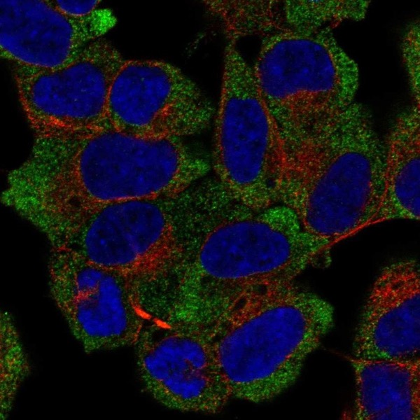 Immunocytochemistry/ Immunofluorescence - Anti-NACA1 antibody (AB221950)