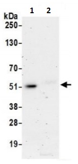 Immunoprecipitation - Anti-NADK antibody (AB241424)