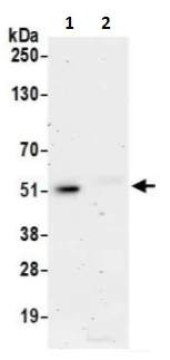 Immunoprecipitation - Anti-NADK antibody (AB241424)