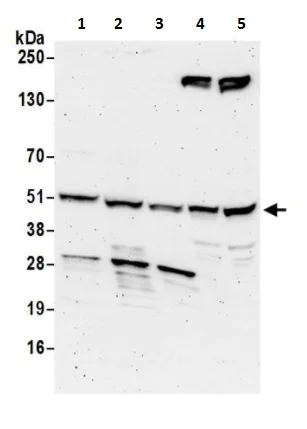 Western blot - Anti-NADK antibody (AB241424)