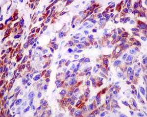 Immunohistochemistry (Formalin/PFA-fixed paraffin-embedded sections) - Anti-NADK2 antibody [EPR13170] (AB181028), expandable thumbnail