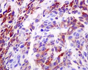 Immunohistochemistry (Formalin/PFA-fixed paraffin-embedded sections) - Anti-NADK2 antibody [EPR13170] - BSA and Azide free (AB250293)