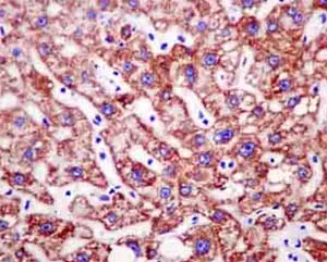 Immunohistochemistry (Formalin/PFA-fixed paraffin-embedded sections) - Anti-NADK2 antibody [EPR13170] - BSA and Azide free (AB250293)