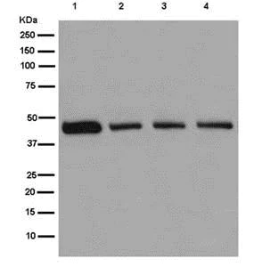 Western blot - Anti-NADK2 antibody [EPR13170] - BSA and Azide free (AB250293)