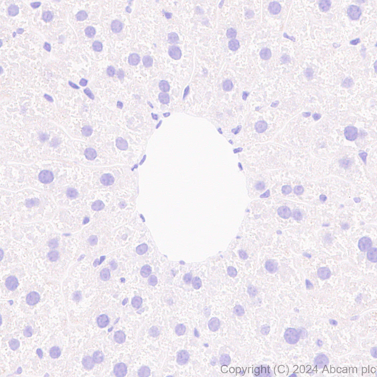 Immunohistochemistry (Formalin/PFA-fixed paraffin-embedded sections) - Anti-NADPH oxidase 4 antibody [EPR28818-92] (AB319055)