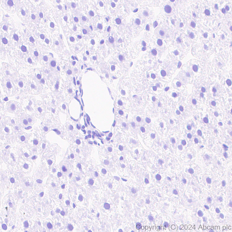 Immunohistochemistry (Formalin/PFA-fixed paraffin-embedded sections) - Anti-NADPH oxidase 4 antibody [EPR28818-92] (AB319055)