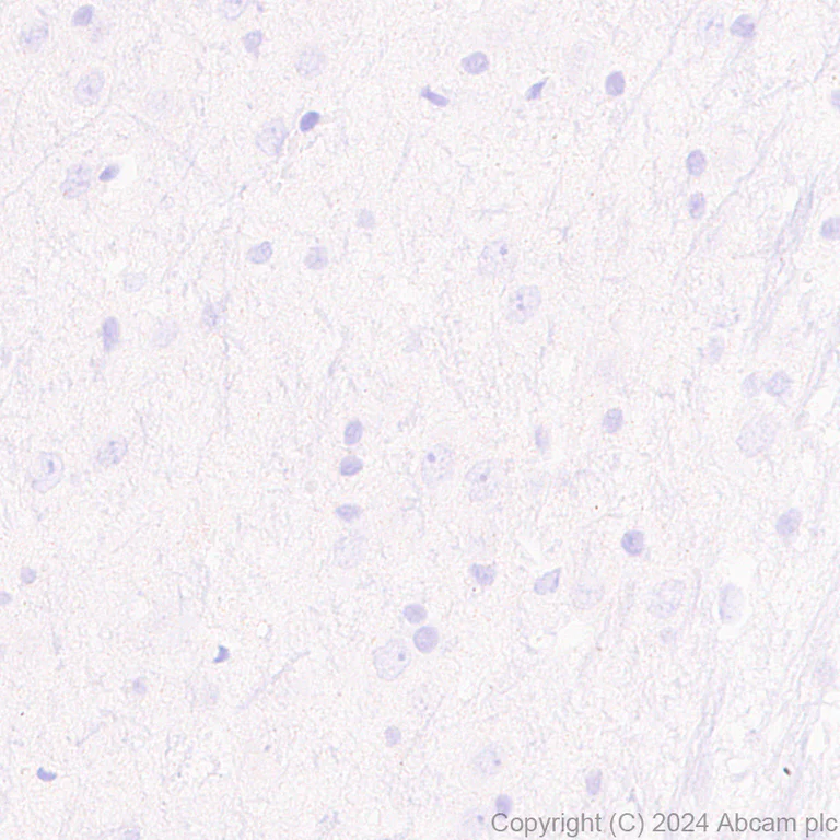 Immunohistochemistry (Formalin/PFA-fixed paraffin-embedded sections) - Anti-NADPH oxidase 4 antibody [EPR28818-92] (AB319055)
