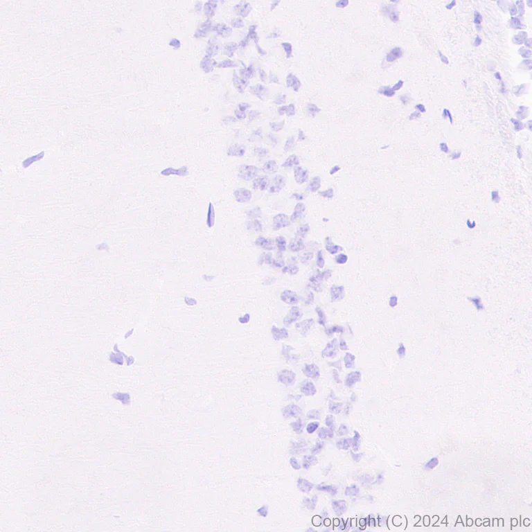 Immunohistochemistry (Formalin/PFA-fixed paraffin-embedded sections) - Anti-NADPH oxidase 4 antibody [EPR28818-92] - BSA and Azide free (AB319056)