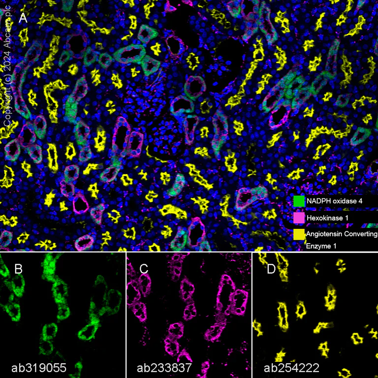 Multiplex immunohistochemistry - Anti-NADPH oxidase 4 antibody [EPR28818-92] - BSA and Azide free (AB319056)