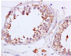 Immunohistochemistry (Formalin/PFA-fixed paraffin-embedded sections) - Anti-NADSYN1 antibody [EPR10611] - BSA and Azide free (AB249661), expandable thumbnail