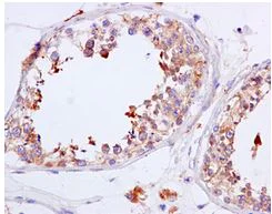 Immunohistochemistry (Formalin/PFA-fixed paraffin-embedded sections) - Anti-NADSYN1 antibody [EPR10611] - BSA and Azide free (AB249661)