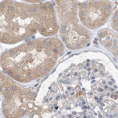 Immunohistochemistry (Formalin/PFA-fixed paraffin-embedded sections) - Anti-NAGK antibody (AB203900)