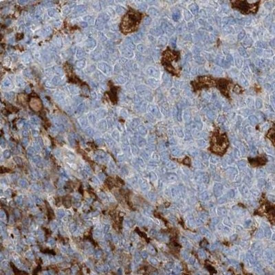 Immunohistochemistry (Formalin/PFA-fixed paraffin-embedded sections) - Anti-NAGK antibody (AB203900)