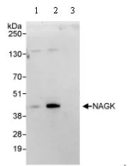 Immunoprecipitation - Anti-NAGK antibody (AB95182)