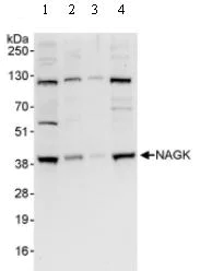 Western blot - Anti-NAGK antibody (AB95182)