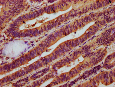 Immunohistochemistry (Formalin/PFA-fixed paraffin-embedded sections) - Anti-NAGPA antibody (AB234978)