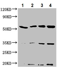 Western blot - Anti-NAGPA antibody (AB234978)
