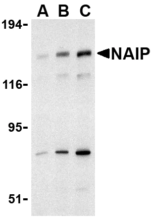 Western blot - Anti-NAIP antibody (AB25968)