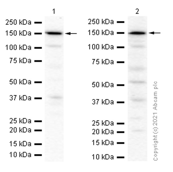 Western blot - Anti-NAIP antibody [EPR6169] (AB129079), expandable thumbnail